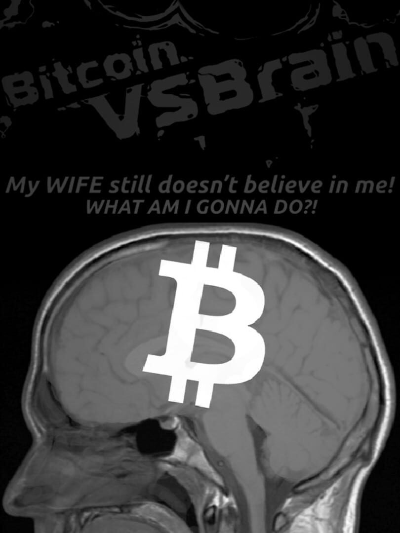Bitcoin VS Brain カバー